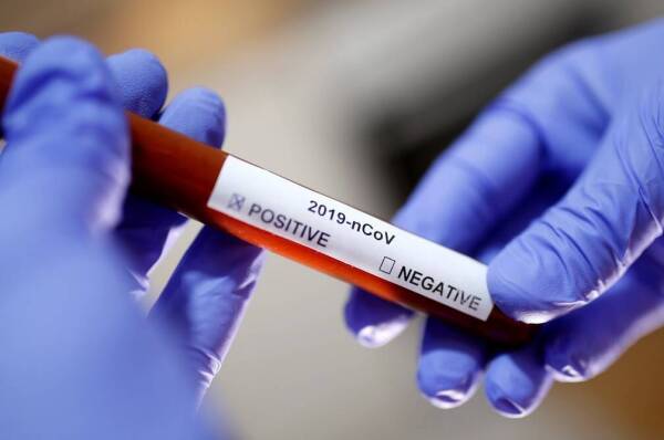 coronavirus-labs