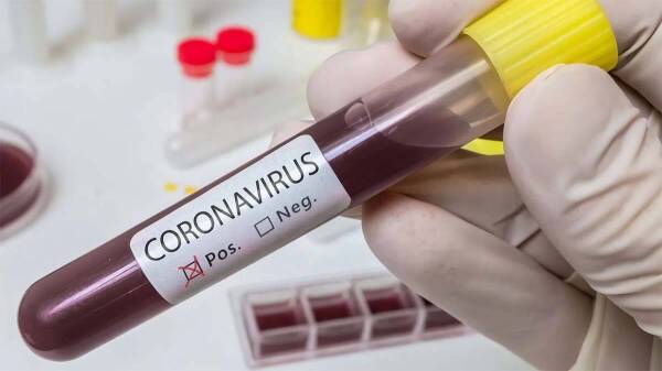 Coronavirus-positivo