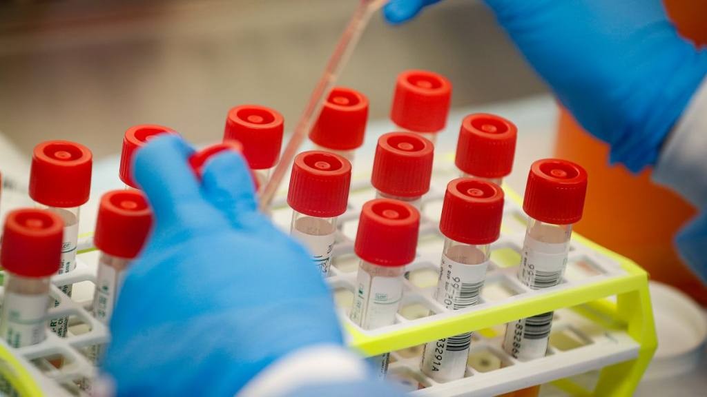 coronavirus-tests