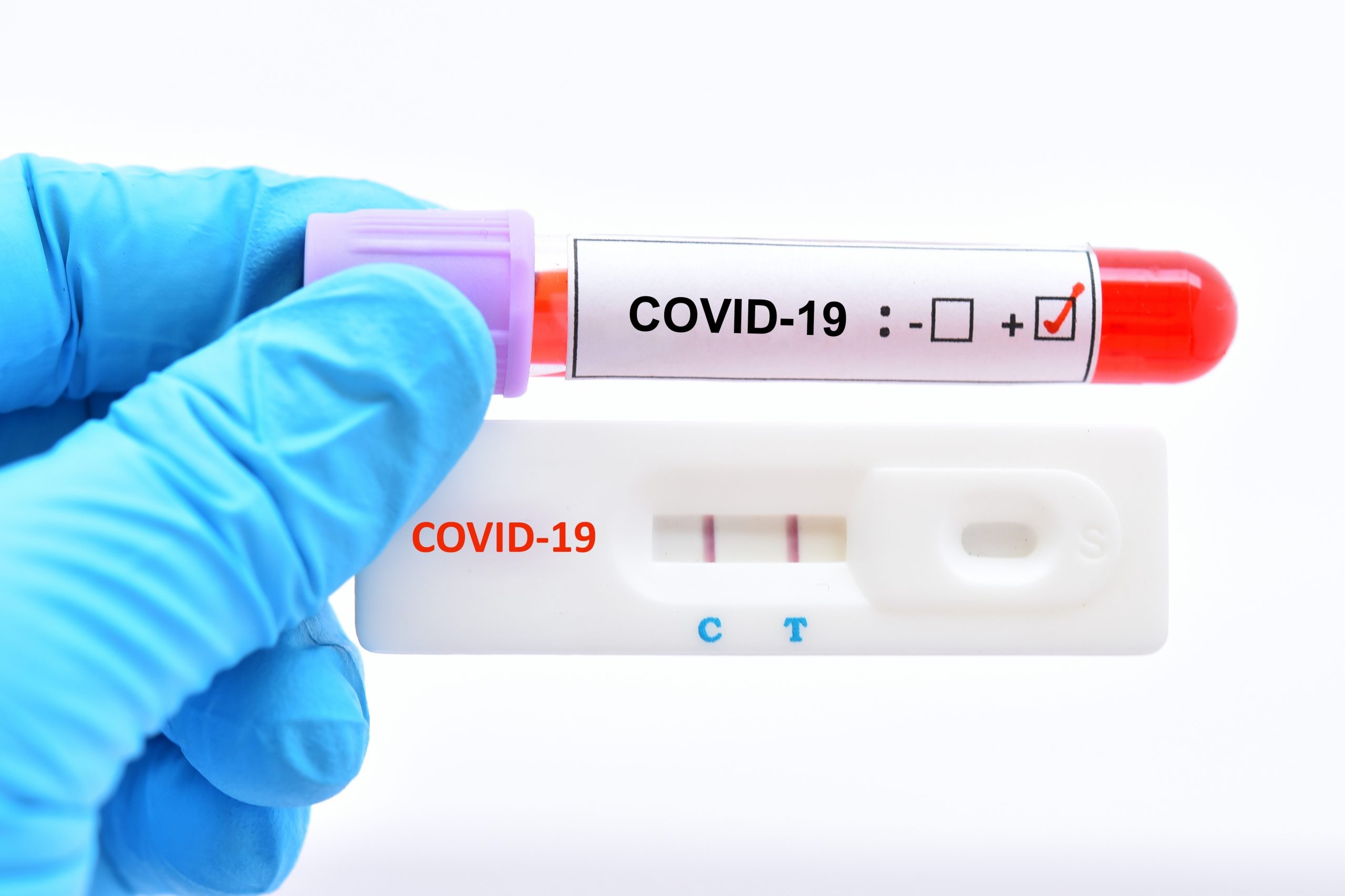 Covid-19-examen
