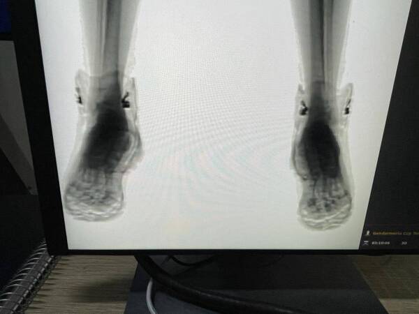 Imagen Body Scan