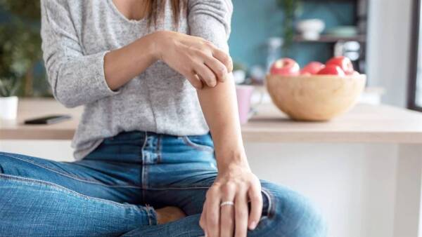 Psoriasis foto referencial