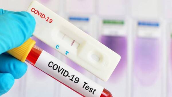 test-coronavirus