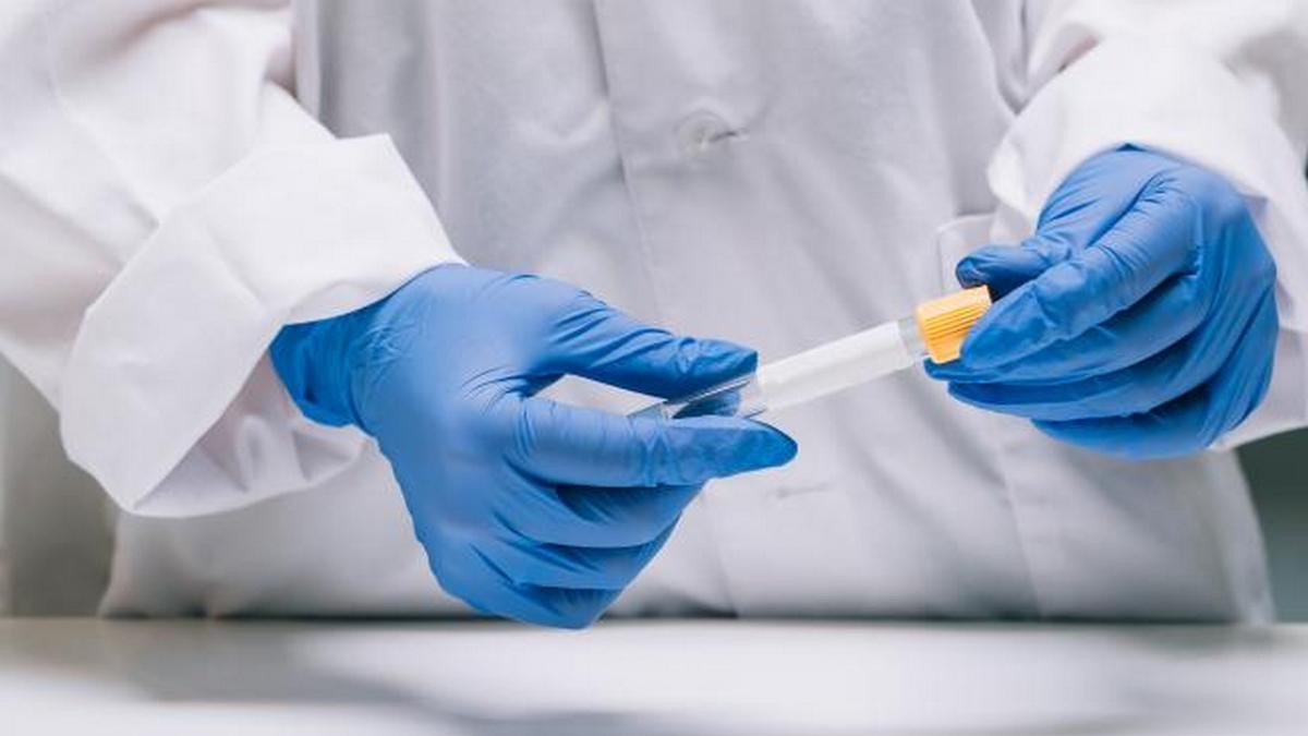 test-coronavirus26