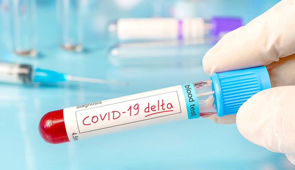 Variante-Delta-del-SARS-Cov-2 (1)