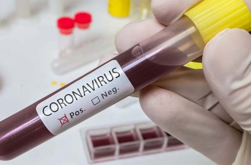  123 Nuevos Contagios Por Covid La Araucanía Hoy Registró Alza En Los Casos Con 2.137 Test PCR Procesados